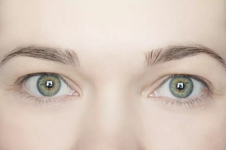 Hvordan fjerne det sultne øyelokk? 49 bilder Hvordan bli kvitt hjemmet, måter å stramme toppposen over øynene uten kirurgi 15752_7