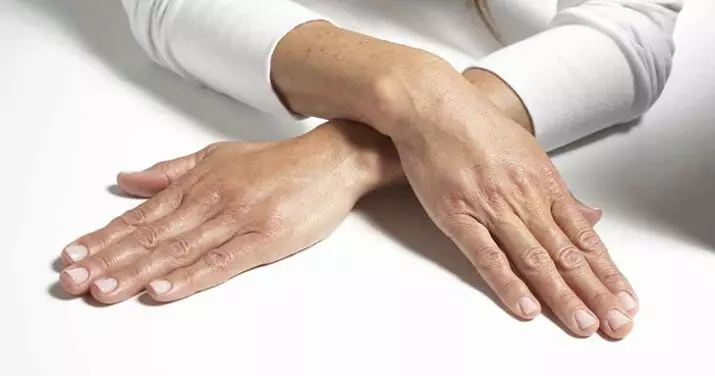 Hand Mesotherapie (19 Biller): Fraktioun Injektiounen fir Hautfleeg, Bewäertungen 15775_15
