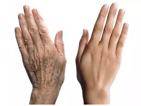 Hand Mesoterapy (19 сүрөт): Териге кам көрүү, сын-пикирлер үчүн бөлчөк сайма 15775_17