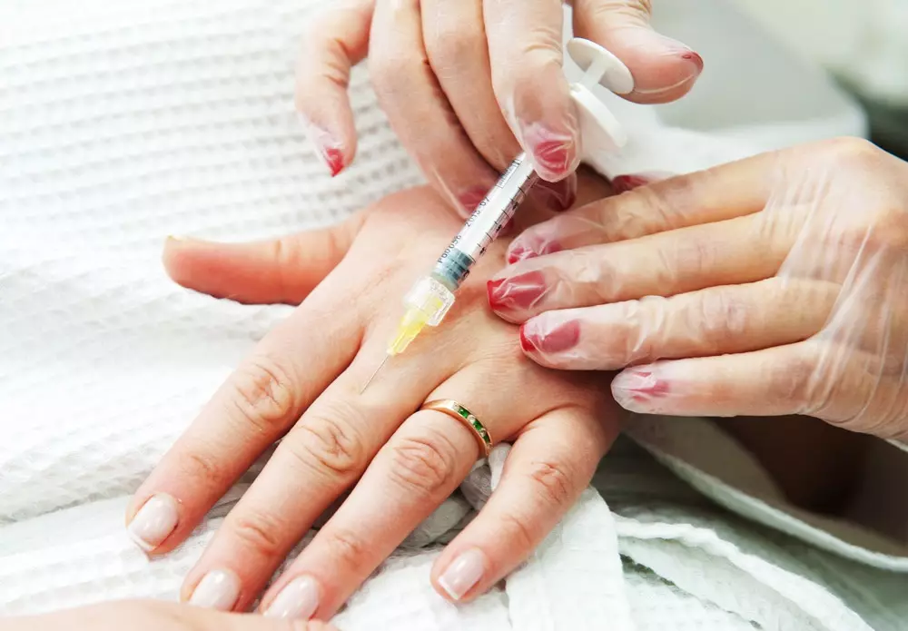 Hand Mesotherapie (19 Pictures): Fractional inspuitings vir Skin Care, resensies 15775_7