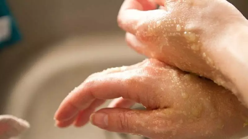 Peeling für Hände (21 Fotos): chemische Option zu Hause auf ihrem eigenen und professionell in der Kabine 15784_3