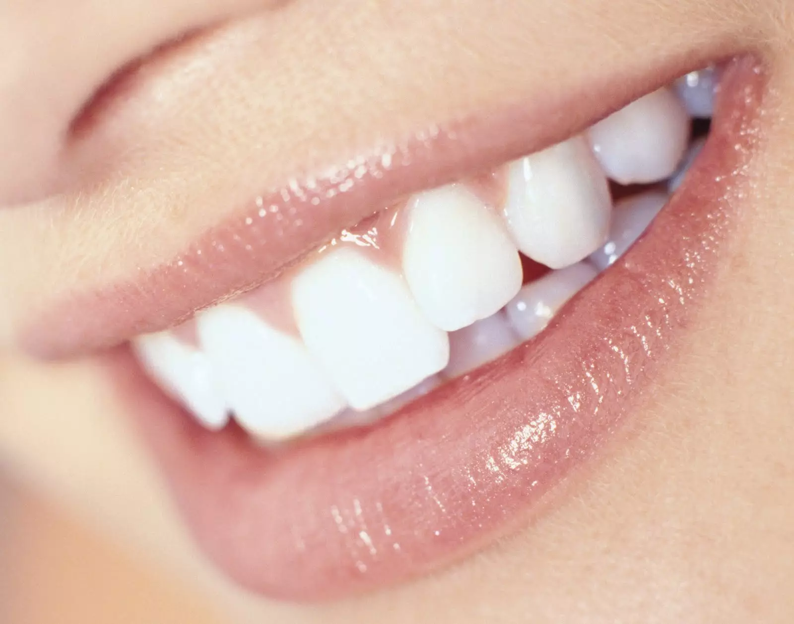 Koliko puta dnevno trebate četkati zube? Koliko često ih možete očistiti? Bolje očistiti ujutro ili navečer? Je li to moguće odmah nakon jela? 15797_3