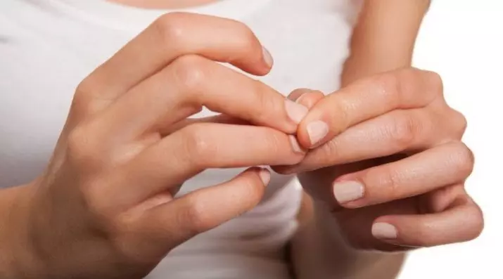 釘は敷設（30枚の写真）：親指を剥がし、皮膚の手の上に剥がれます。なぜ爪と女性が落ち着いているのですか？ 15810_23