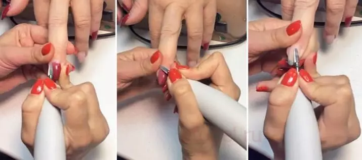 釘は敷設（30枚の写真）：親指を剥がし、皮膚の手の上に剥がれます。なぜ爪と女性が落ち着いているのですか？ 15810_24