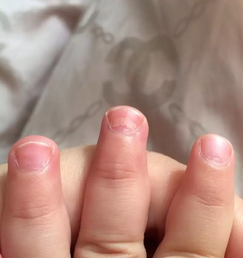 손톱이 얼마나 빨리 자랄 수 있습니까? 한 달 동안 얼마나 많은 손톱이 자랍니다. 그리고 어떤 속도로? 손톱의 원인, 위로, 파도가 손에 있습니까? 15811_20