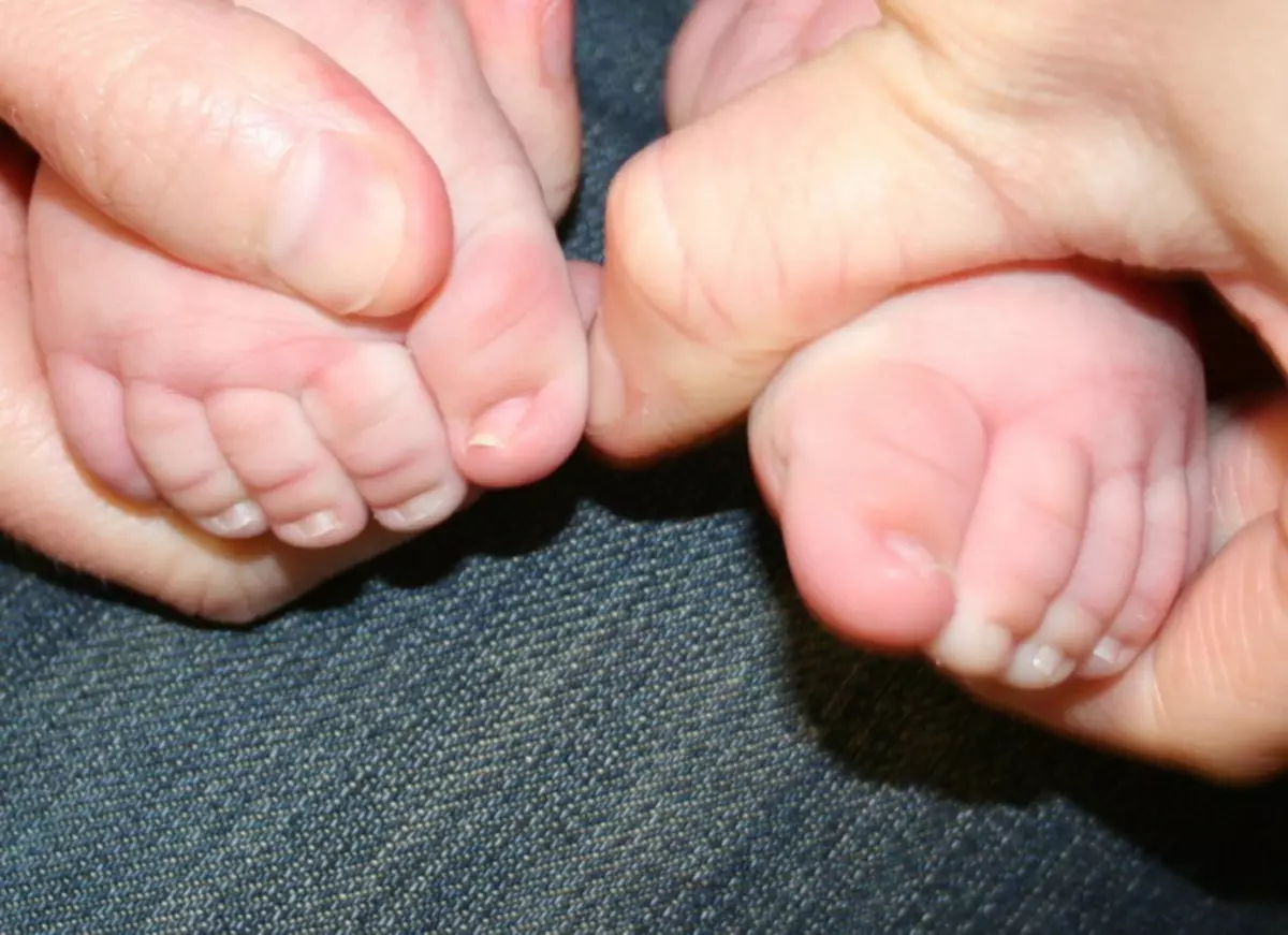 Рука нога когда у ребенка. Врошийся ноггть у грудничка. Ногти на ногах у новорожденного.