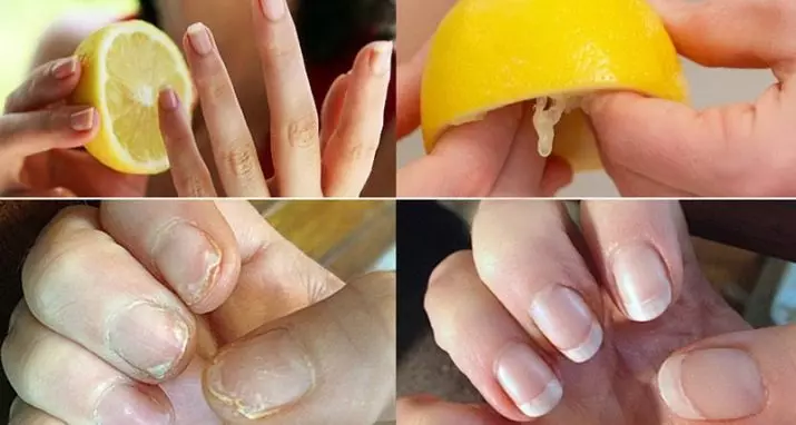Jak wzmocnić paznokcie w domu? Czy można rozmazać kruche paznokcie na rękach jodu, aby wzmocnić? Jak używać orzechów i innego oleju z apteki? 15820_16