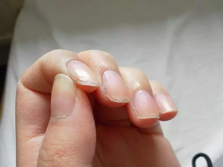 Hur stärker du naglarna hemma? Är det möjligt att smita spröda naglar på händerna på jod för att stärka? Hur man använder nutty och annan olja från apoteket? 15820_4
