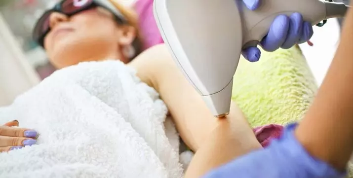 Laser Epilation Bikini Dalam (18 Foto): Bagaimana Epilasi Zona Bikini dengan Laser? Persiapan untuk prosedur. Apa yang termasuk? Ulasan setelah prosedur 15995_2