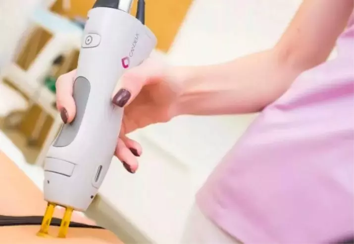 Laser epilation djúpt bikiní (18 myndir): Hvernig virkar bikiní svæði með leysir? Undirbúningur fyrir málsmeðferðina. Hvað er innifalið? Umsagnir eftir málsmeðferðina 15995_4