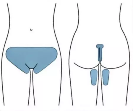 Bikini vaska zonas depilācija (19 fotogrāfijas): kā padarīt vaska intīmo epilāciju mājās? Matu noņemšana ar vaxing ar siltu vasku 15996_6