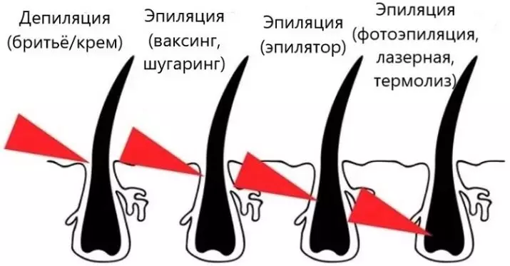 דפילציה (15 תמונות): מה זה? איך לעשות רגל ידית יד בבית? מינים, מתכונים, קרמים וג'לים לאחר הדירוג 15998_2