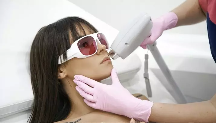 Hoeveel laser prosedures hair removal vir volledige hair removal? Na hoeveel dae of sessies is hare vir ewig? 16000_7