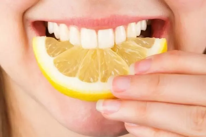 Hoe je je tanden thuis te whiten? 34 foto het beste middel om te bleken met je eigen handen. Hoe maak je snel witte tanden thuis? 16128_19