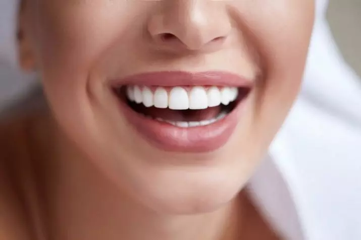 Hoe je je tanden thuis te whiten? 34 foto het beste middel om te bleken met je eigen handen. Hoe maak je snel witte tanden thuis? 16128_3