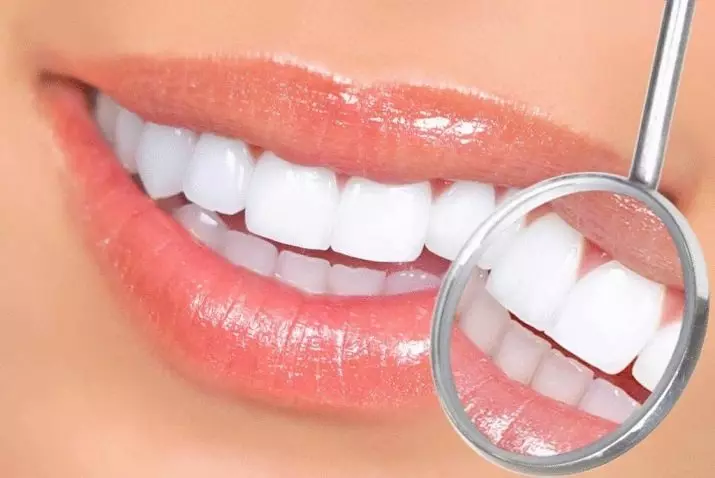 Balināšanas sloksnes zobiem: labākās balināšanas plāksnes. Kā izmantot? Kaitīga vai palīdzība? Reitings un kā izmantot atsauksmes 16130_19