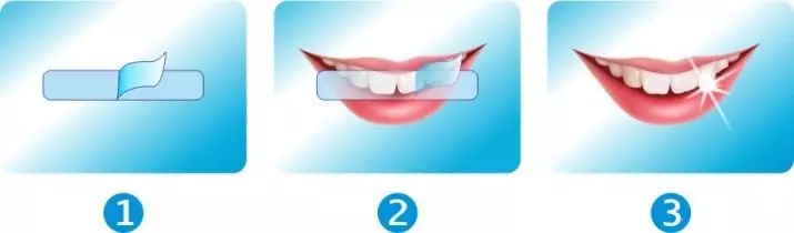 Balināšanas sloksnes zobiem: labākās balināšanas plāksnes. Kā izmantot? Kaitīga vai palīdzība? Reitings un kā izmantot atsauksmes 16130_39