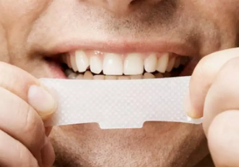 Balināšanas sloksnes zobiem: labākās balināšanas plāksnes. Kā izmantot? Kaitīga vai palīdzība? Reitings un kā izmantot atsauksmes 16130_6