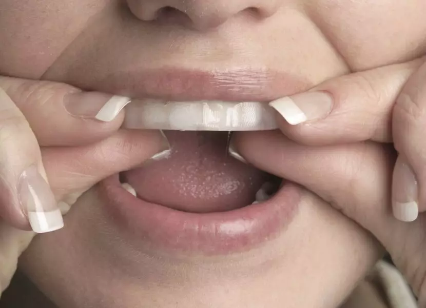 Balināšanas sloksnes zobiem: labākās balināšanas plāksnes. Kā izmantot? Kaitīga vai palīdzība? Reitings un kā izmantot atsauksmes 16130_9