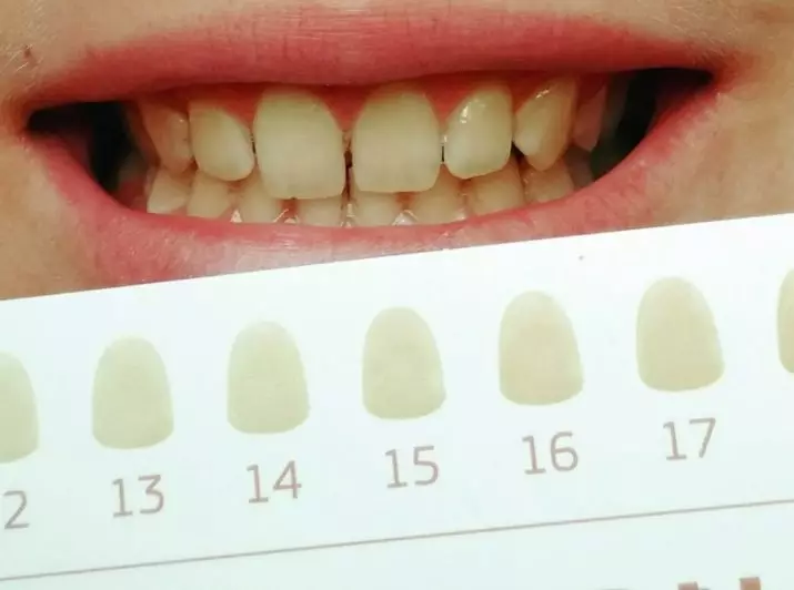 Blyanter til tandblegning: Tænder Whitening Pen, Global White og andre. Sådan bruger du tandhåndtag til at fjerne plaque? 16150_10