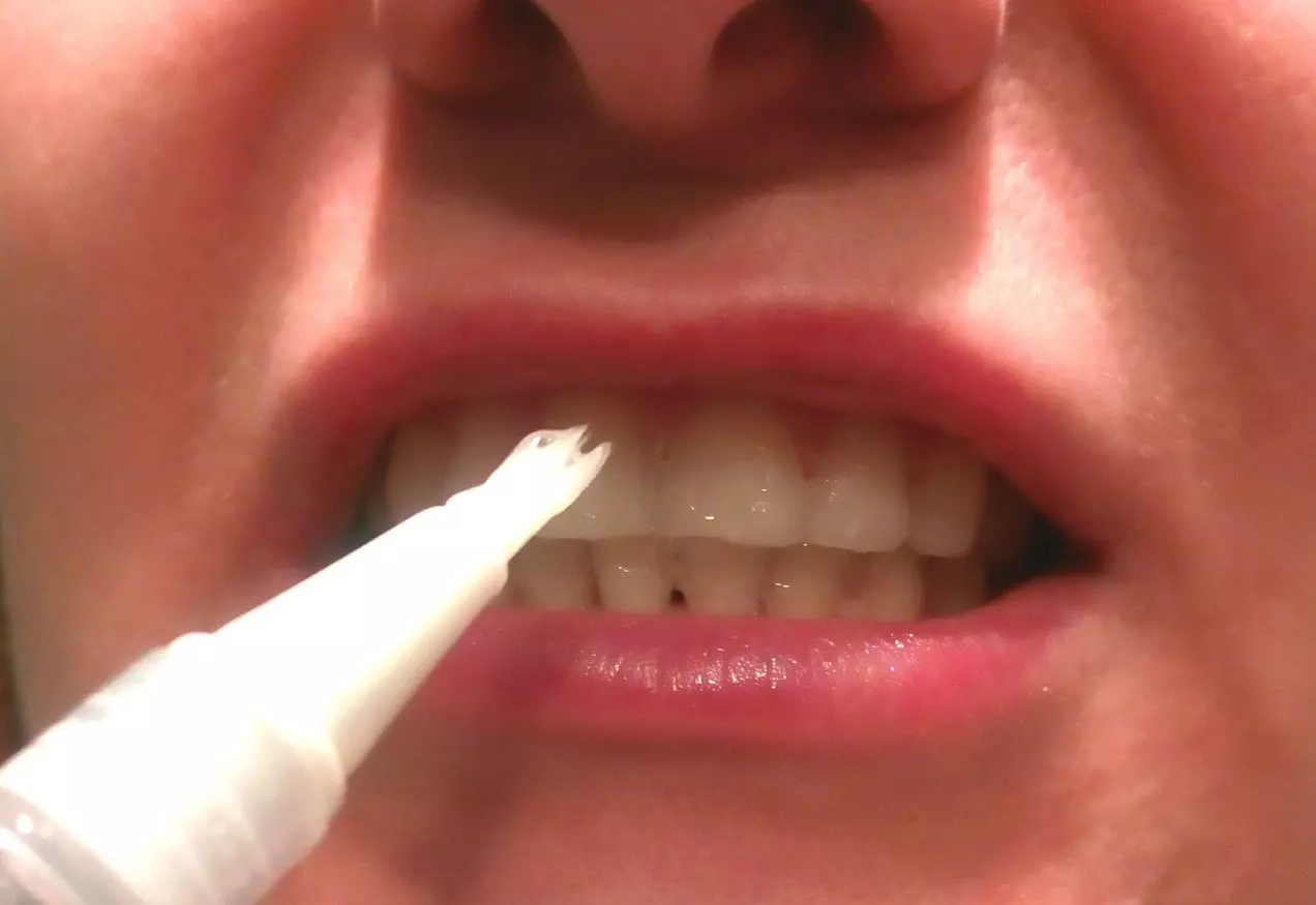 दात whitening साठी pencils: दात whitening पेन, वैश्विक पांढरा आणि इतर. प्लाक काढण्यासाठी दंत हँडल कसे वापरावे? 16150_28