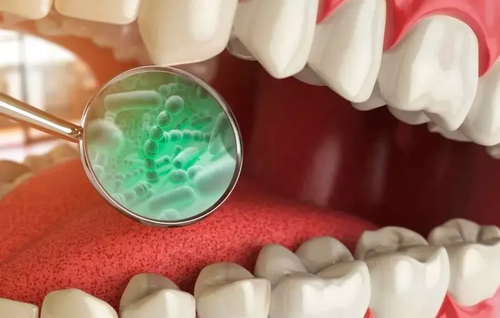 ფანქრები კბილების გათეთრება: კბილების გათეთრება კალამი, გლობალური თეთრი და სხვა. როგორ გამოვიყენოთ სტომატოლოგიური სახელურები, რათა ამოიღონ დაფა? 16150_5