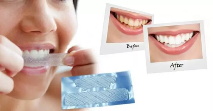 Whitening Strips Crest 3D White: Si t'i përdorni ato për zbardhjen e dhëmbëve? Udhëzimet për strips whitestrips efektet profesionale dhe të tjerët 16157_32