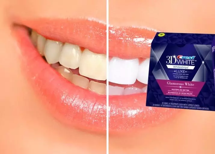 Whitening Strips Crest 3D White: Si t'i përdorni ato për zbardhjen e dhëmbëve? Udhëzimet për strips whitestrips efektet profesionale dhe të tjerët 16157_33