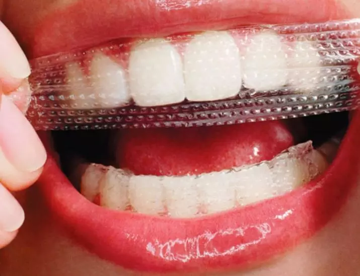 Whitening Strips Crest 3D White: Si t'i përdorni ato për zbardhjen e dhëmbëve? Udhëzimet për strips whitestrips efektet profesionale dhe të tjerët 16157_6