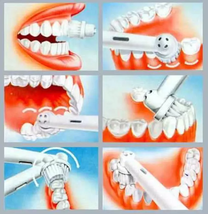 Elektrikli diş fırçaları (52 fotoğraf): Dişler için iyi elektrolatlar. Bir yetişkin nasıl seçilir? Artıları ve eksileri, diş hekimleri yorumlar 16160_45