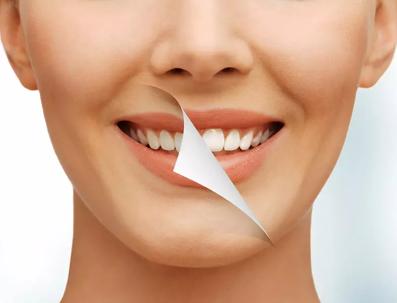 Pemutihan Toothstes: Menilai pasta terbaik untuk pemutihan gigi, jepun yang cekap dan pasta lain, profesional, ulasan 16168_16