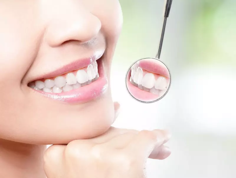 Blanchiment dentifrice: note les meilleures pâtes pour blanchiment des dents, japonais efficaces et autres pâtes, professionnels, examens 16168_22