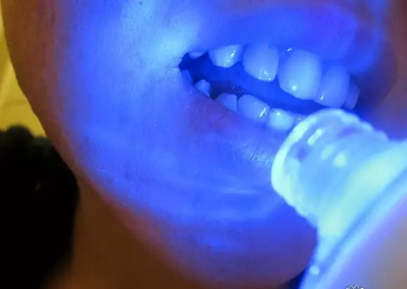 Blanx pastă de dinți: albire suplimentară albă și med, tratare a șocurilor albe și alte produse, recenzii 16183_19