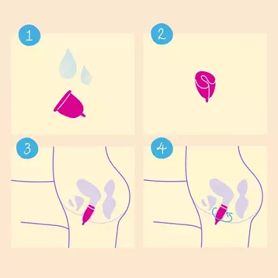 Menstruationsschüssel: Was ist es und wie zu verwenden? Was ist nötig und wie funktioniert es? Was sieht es aus und wie soll man wählen? Maße 16250_11