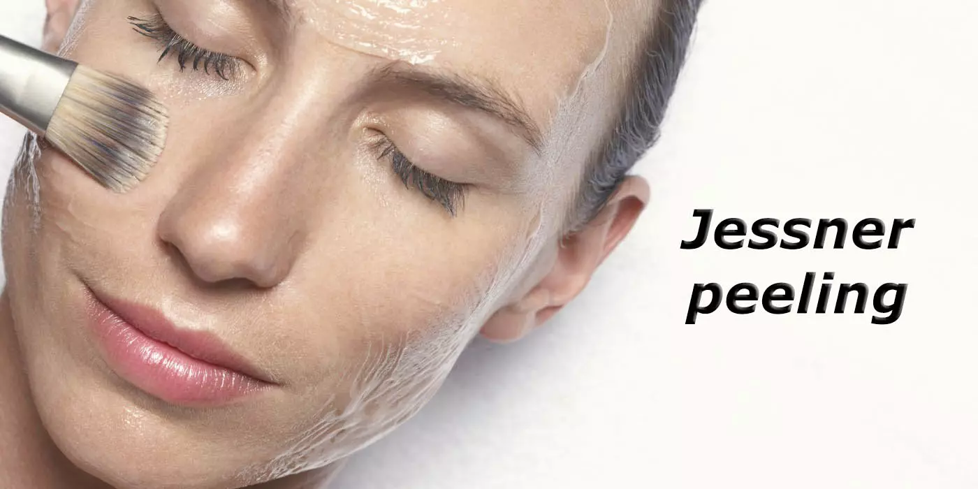 Peeling Jessner (28 fotos): el que és, l'efecte després de tractaments facials de Hollywood, contraindicacions, la composició d'aplicacions, opinions 16396_2