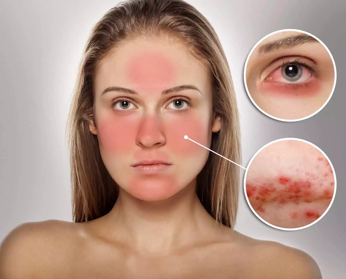 Miofascial Facial Massage - ဘာလုပ်စရာတွေ, လုပ်ထုံးလုပ်နည်းများကိုလုပ်ထုံးလုပ်နည်းများ, 16434_12