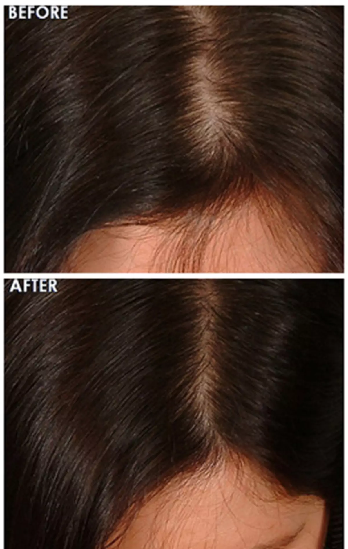 Peigne Laser (24 photos): Power Grow Comber Peigne et Miles de cheveux de la perte de cheveux et de leur croissance, des critiques des clients 16550_23
