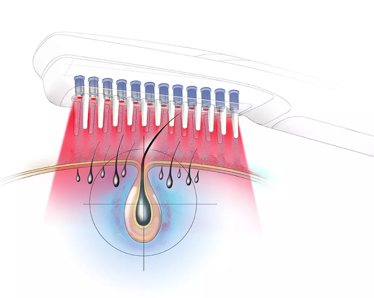 लेजर कंघी (24 फोटो): बालों के झड़ने और उनके विकास, ग्राहक समीक्षा से बिजली और हेयरमैक्स की शक्ति बढ़ती है 16550_6