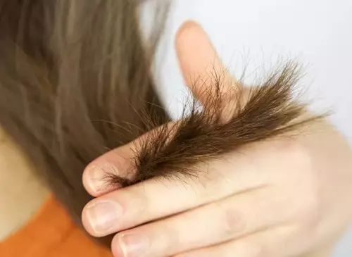 Cepillo de cabelo (28 fotos): Mellores medios contra o luxo. Cales son as causas do luxo nas mulleres? Como restaurar o cabelo na casa? 16583_2