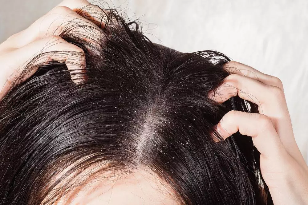洗髮水，口罩等手段的選擇：頭髮的化學捲曲後護理。如何照顧在家捲髮？ 16639_13