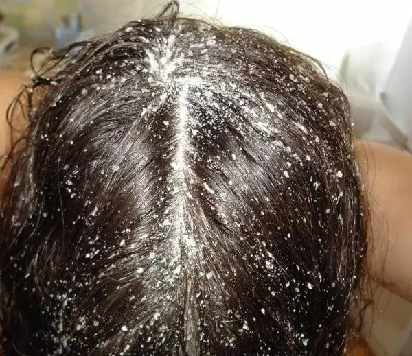 Hur stärker du håret? Örter och kapslar, lotioner och tinktur, ampuller och andra medel för att stärka håret hemma 16755_48
