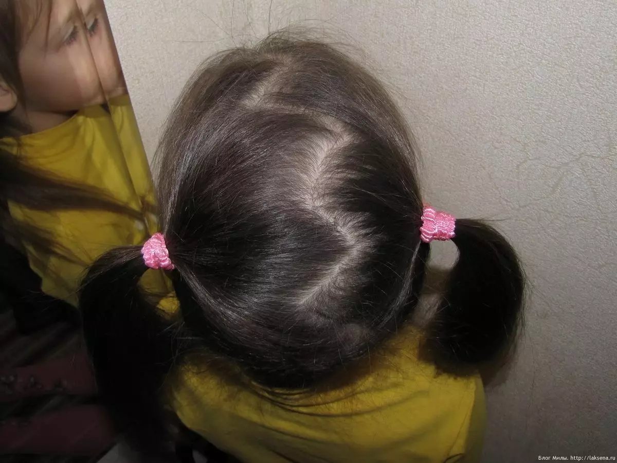 Hairstyles voor meisjes voor elke dag (74 foto's): maak een eenvoudige mooie casual kapsels van kinderen voor meisjes 6, 8 en 14 jaar in 5 minuten 16810_19