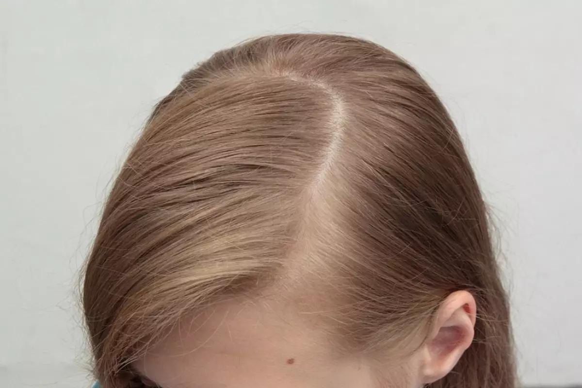 女の子のための噂を持つヘアスタイル（64写真）：小さなゴムバンドを使った子供のヘアスタイル、長く短い髪の女の子のための美しい選択肢 16816_19
