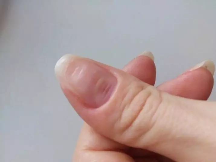 Is Shellac schadelijk voor nagels? 11 foto's schade en gebruik van materiaal. Bedorft hij zijn nagels? Feedback-experts 16992_6