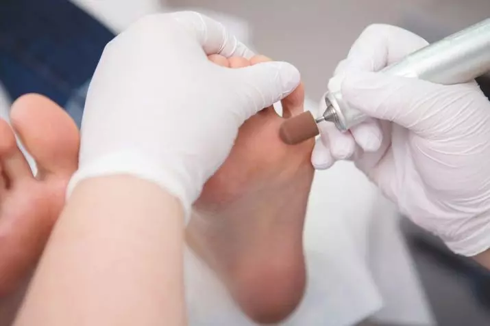 Апаратний педикюр (24 фото): як робити обробку нігтів покроково? Плюси і мінуси професійної медичної техніки, відгуки 17282_7