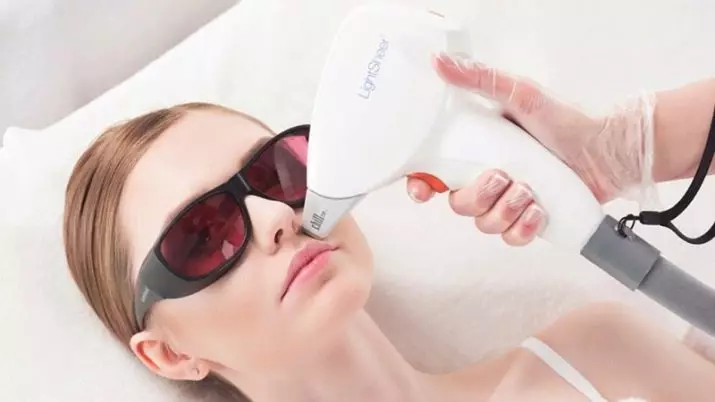 Epilasi muka (8 foto): Pembuangan rambut wanita dengan laser, diod dan cara lain untuk wanita di rumah, bagaimana untuk menenangkan kulit selepas prosedur 23285_4