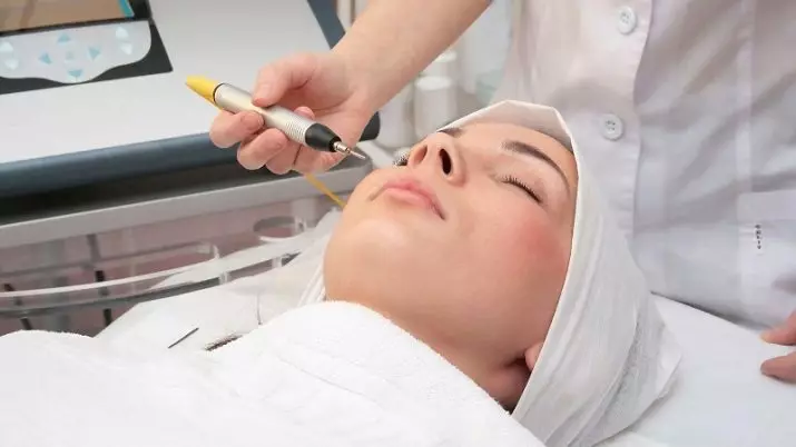 Face Epilation (8 bilder): Kvinners hårfjerning med en laser, en diode og andre måter for kvinner hjemme, hvordan å roe huden etter prosedyren 23285_6