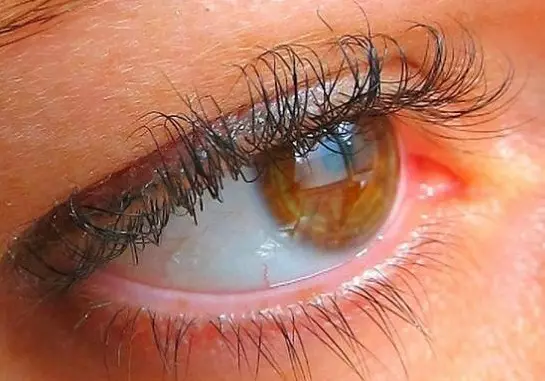 લેમિનેટેડ eyelashes માટે કેવી રીતે કાળજી લેવી? લેમિનેશન પ્રક્રિયા પછી ઘર પર આંખની છિદ્રોની સંભાળ અને પુનઃપ્રાપ્તિ, લાંબા સમય સુધી ભલામણો 23713_12