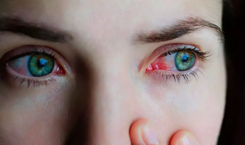Laminering av korta ögonfransar (13 bilder): Vad ser korta ögonfransar ut efter laminering? Funktioner i proceduren och efterföljande vård 23722_10