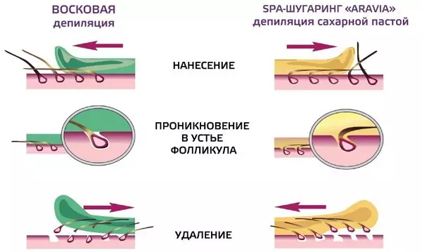 Cire ou shuging: Qu'est-ce qui va mieux? Comparaison de l'épilation à la cire et du shuging. Quel est différent de l'épilation de la pâte de sucre? Quelle est la procédure plus? 23847_13